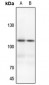 Anti-EPHA3 Antibody